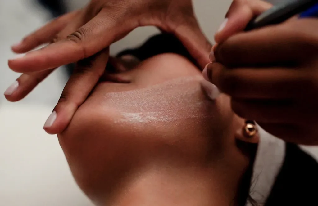 Peeling de cristal: o que é, como funciona e quais cuidados ter